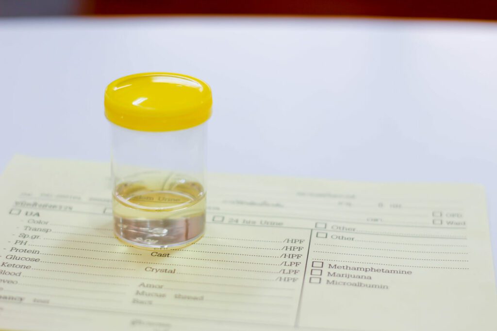 Urine sample for drug testing