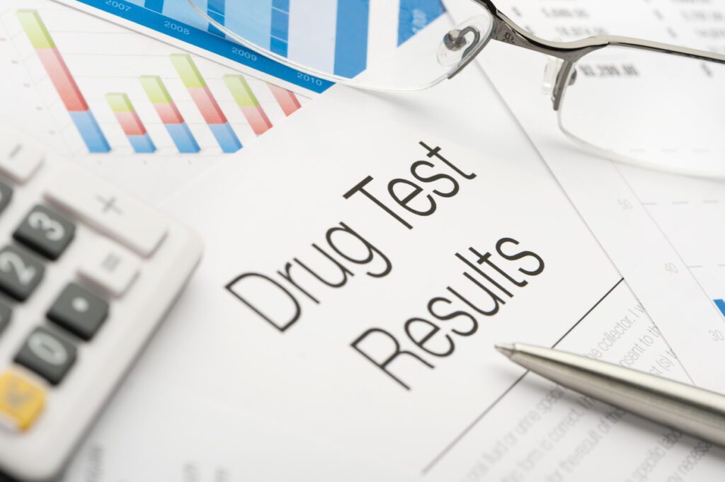 Drug testing in the workplace image of results.