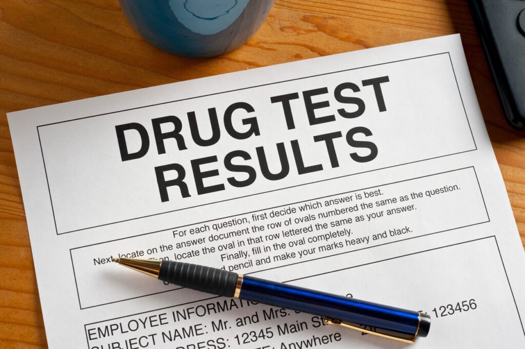 Image of Pre-Employment and Random Drug Testing Results.